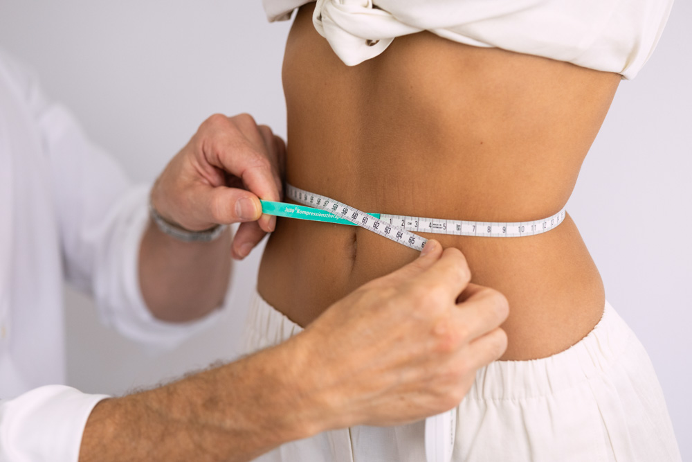 Körperstraffung am Bauch