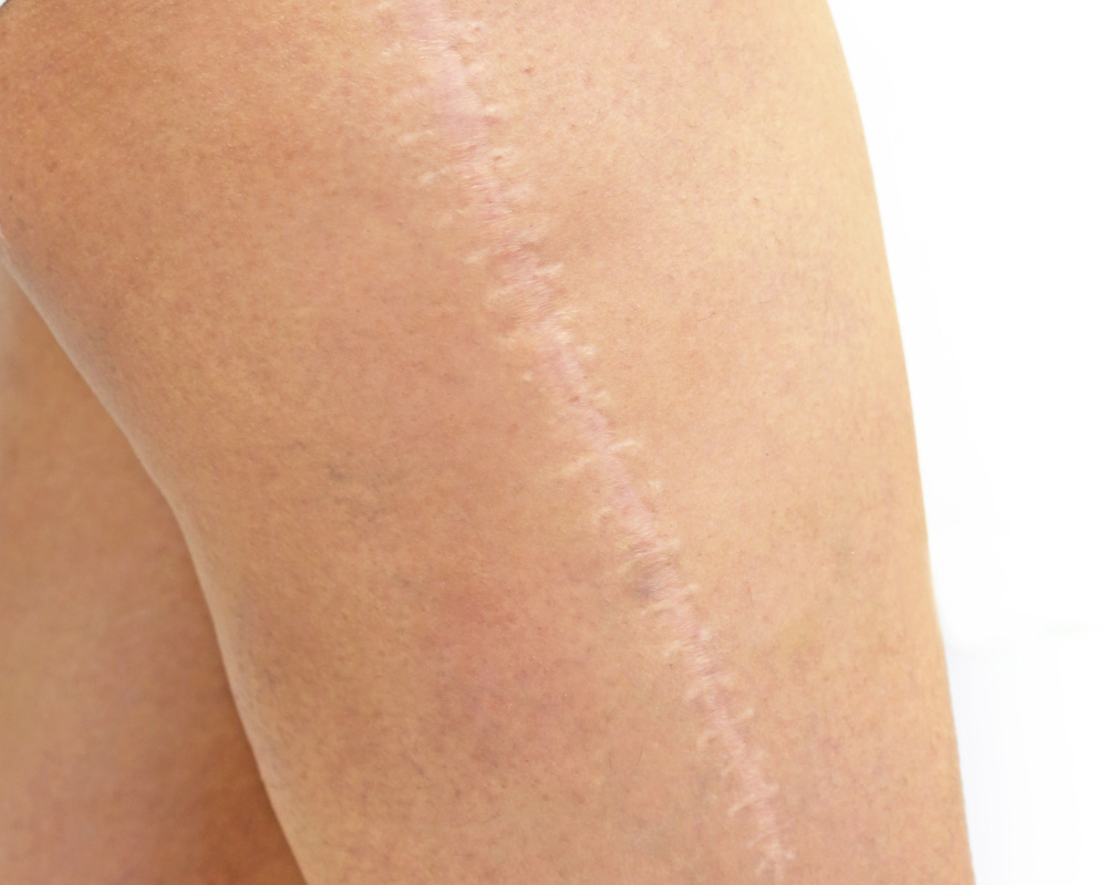 Karte narbe verschoenern naehe muenchen zentrum